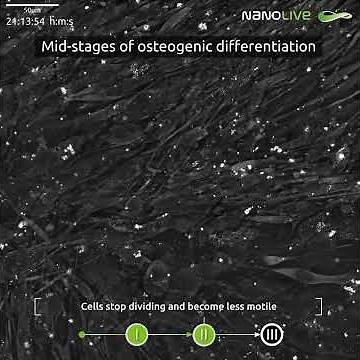 Mesenchymal stem cell differentiation into osteoblasts