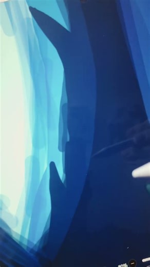 Demon Slayer frame redraw #funny #art #V.S #Demonslayer #entertainmentdistrictarc #daki #Violetscar