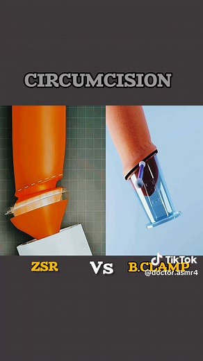 Understanding Circumcision Surgery Procedures