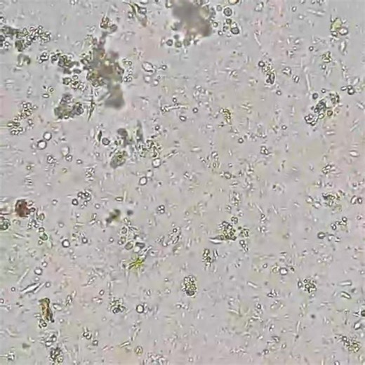 140K views · 1.2K reactions | Stool sample   | Lab life | Facebook