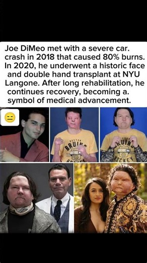 From Burn Survivor to Medical Miracle ❤️🔥 #viral