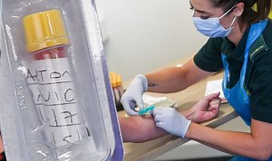 T-cells: Possibilities of coronavirus immunity explained by expert