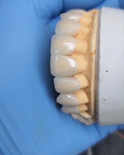 Mecca Dental Studio Cosmetic Dental Lab on Reels