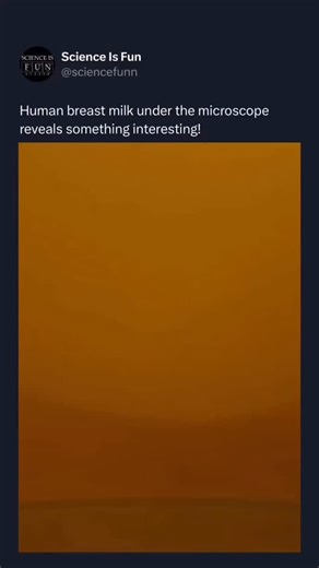 Science Is Fun By Tomas Rosko on Instagram: "“Human breastmilk is more than just nutrition — it’s a living, dynamic substance. Under the microscope, you’ll see fat globules suspended like tiny galaxies, immune cells moving with purpose, and complex proteins forming intricate patterns. It adapts to a baby’s needs in real-time, delivering antibodies, enzymes, and even stem cells. What looks simple on the outside is biologically brilliant up close.” “These clips reveals the hidden complexity of bre