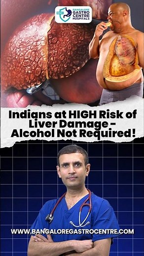 Why Indians Are at HIGH Risk of Liver Damage — Even Without Alcohol! (Doctor Explained)