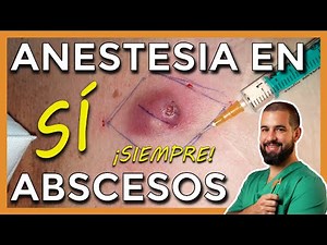 How to administer local anesthesia to drain an abscess. Real video explained.