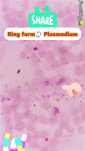 🌏🔥 What Parasitic disease Causes the most Serious Global Issue⁉️💍👍Parasitology👍🦟🔬📚✅