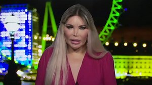 Former 'Human Ken Doll' reveals she has had 75 plastic surgeries