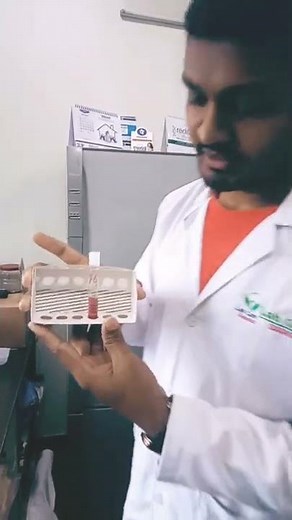 Sickling test and result