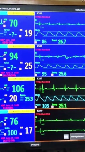 Central monitor, connect with all monitor #patientcare #patientsafety #patient_monitor #philips