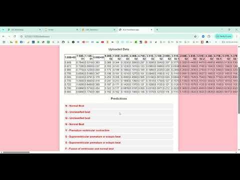 ECG Congestive Heart Failure Detection in Python Projects