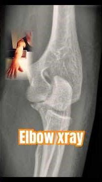 Special positions elbow xray 🩻￼