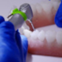 Video: Dynamic Navigation in Endodontics: Guided Access Cavity Preparation by Means of a Miniaturized Navigation System
