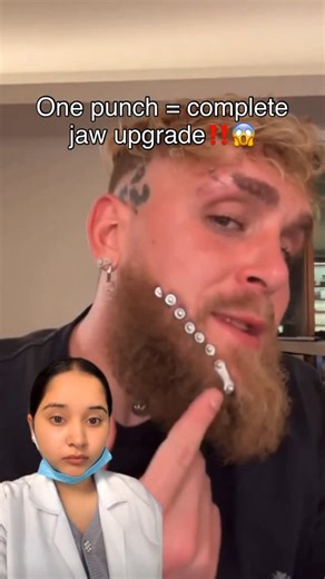 Dr. Aashita Sharma || Dentist & Creator on Instagram: "One punch = full mouth rehab 🥊🦷 That single punch caused multiple fractures in the lower jaw (mandible). To fix it, surgeons performed ORIF surgery (Open Reduction and Internal Fixation) — where the broken jaw bones are realigned and secured using titanium plates and screws so the bite, jaw function, and facial structure can heal properly. This is why mouthguards exist. #jakepaul #dentistry #anthonyjoshua #reels #trending #viral #fyp"