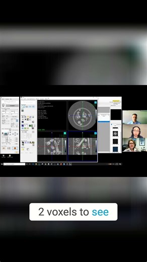 CT Scan Secret Voxel Size Rules REVEALED!