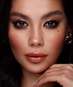 Anti-Wrinkle Injections