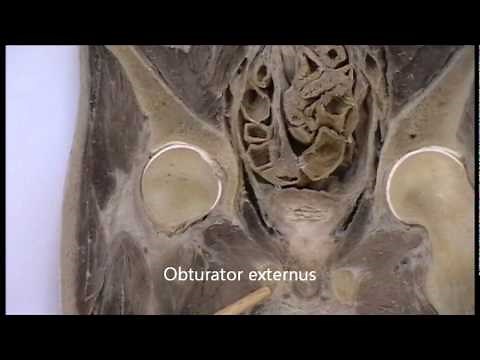 sectional anatomy of the abdomen and pelvis coronal section 2