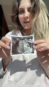 981K views · 10K reactions | 懶﫶 ya que me hicieron 500 ultrasonidos, haré muchos videos así jajaja #5weekpregnancy #ttc #newborn #baby #5weekbaby #4thtrimester | Hola Sunshine | Facebook