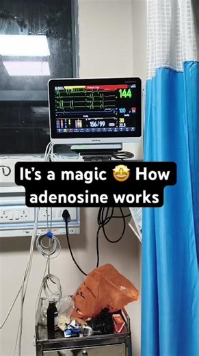 Adenosine works like a magic