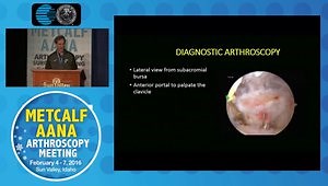 Horizontal Instability of the AC Joint - Recognize and Treat
