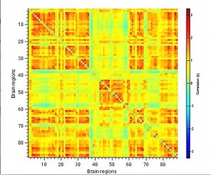 Dynamic functional connectivity