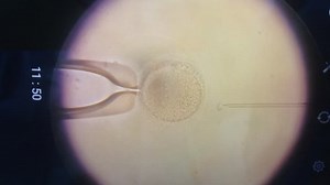 Female Egg Under Powerful Microscope Fertilized Stock Footage Video (100% Royalty-free) 1017025459 | Shutterstock