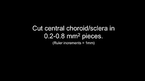 File:Choroid-Sprouting-Assay-An-Ex-Vivo-Model-of-Microvascular-Angiogenesis-pone.0069552.s004.ogv - Wikimedia Commons