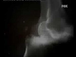 House MD Intro (Season 1)