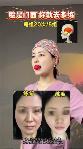 Unlock Flawless Facades: Master Facial Exercises for Lifted Features!FacialExerciseFacialT