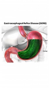 Very Nice Medical Animation | Medical Talks