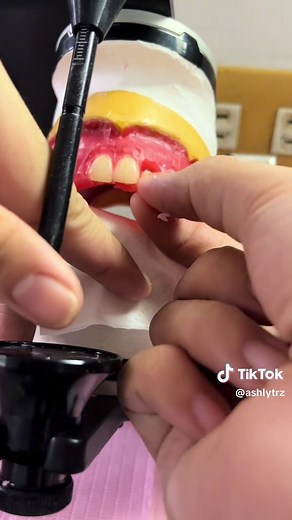 Anterior Setting for Complete Denture Explained