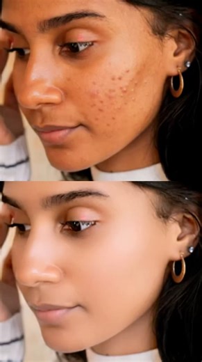 Smooth face in Photoshop | how to clean and smooth face photo clean #viral #youtubeshorts