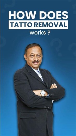 How Tattoo Removal Works | Laser Treatment Explained Step-by-Step