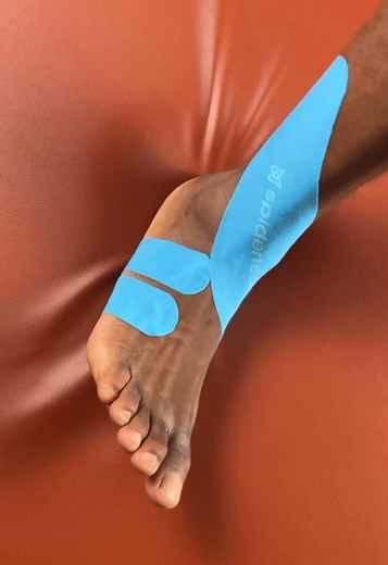 spidertech on TikTok