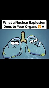 Human animation on Instagram: "Follow @human_animationn for more insane body facts! 🚀 A nuclear explosion doesn’t just destroy cities — it melts your insides. ☢️💀 Your organs? They wouldn’t even stand a chance… Scary or fascinating? Drop your thoughts below. ⬇️ #NuclearExplosion #BodyReaction #OrganFailure #ScienceFacts #HumanBody #DarkButInteresting #WhatIf #Viral #Trending #AnatomyFacts #SurvivalTalk #Radiation #Fyp #Follow #FollowForMore"