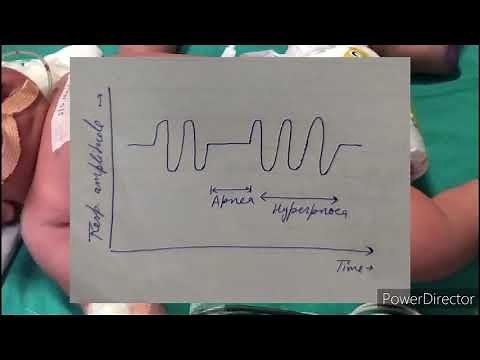 Respiration in children | Pediatrics