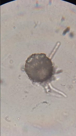 Closeup (around 800x, and 12x speed) of a testate Amoeba