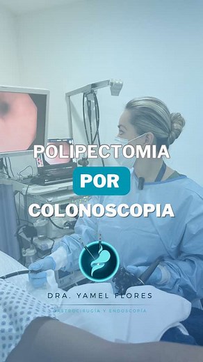 Descubre los Beneficios de la Polipectomía con Tecnología de Vanguardia ¿Sabías que los pólipos en el colon o en el estómago pueden aumentar el riesgo de cáncer? La polipectomía es un procedimiento clave para prevenir problemas graves y mantener tu salud en óptimas condiciones. ¿Qué es la Polipectomía? Es una técnica médica utilizada para eliminar pólipos (crecimientos anormales) en el tracto digestivo. Puede realizarse de manera segura y efectiva a través de procedimientos endoscópicos. Soy la