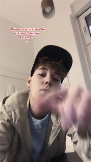 Understanding Facial Scratches: Causes and Remedies