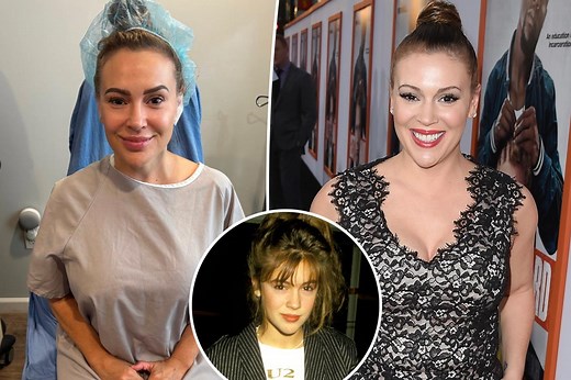Alyssa Milano removes her breast implants: ‘Letting go of the body that was sexualized and abused’