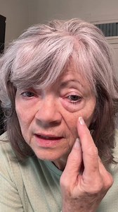 263K views · 156 reactions | Real Results. Really Fast. Plexaderm...