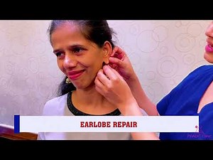 Ear Lobe Repair procedure