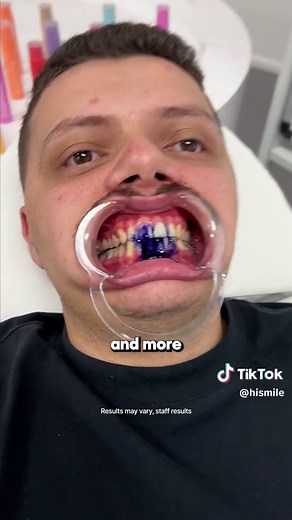 hismile on TikTok