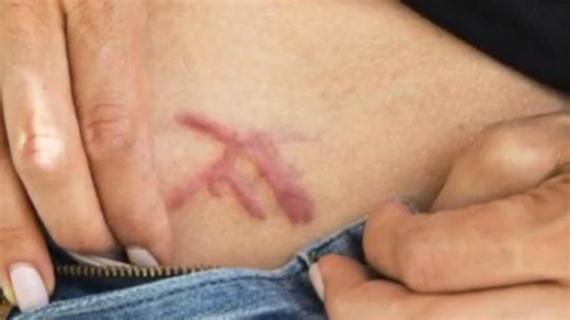 Chilling meaning behind ‘branding’ women were given in Allison Mack sex cult