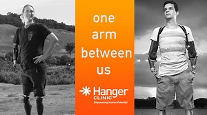 11K views · 416 reactions | We’re thrilled to launch #OneArmBetweenUs, an ongoing YouTube series that will feature Cameron Clapp and Pedro Pimenta answering viewer-submitted questions, sharing their experiences as amputees, and discussing issues that affect the limb loss and limb difference community. “Subscribe” to our YouTube channel and check out the first episode here: www.youtube.com/HangerNews! #HangerClinic | Hanger Clinic | Facebook