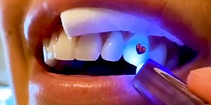 This $25 kit from Gemzeez gives you temporary tooth gems– here's how to apply them