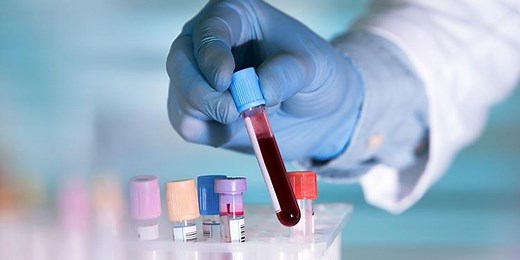 The Truth About Pre-Marital Blood Tests