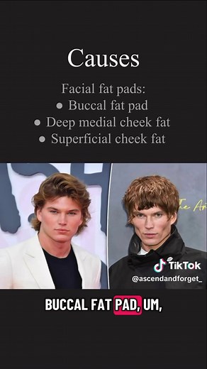 The Ultimate Guide to Hollow Cheeks