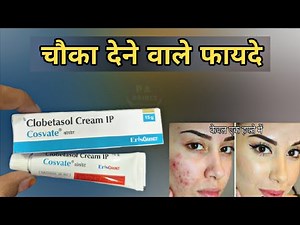 cosvate cream | clobetasol propionate cream | anti function | Prince Azeemuddin | cosvate gm cream