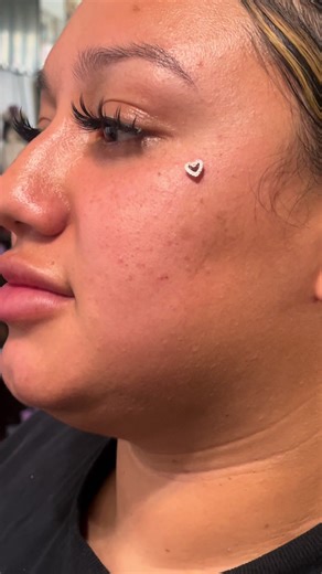 Heart dermal change #piercings #piercing #heart #jewelry #fyp